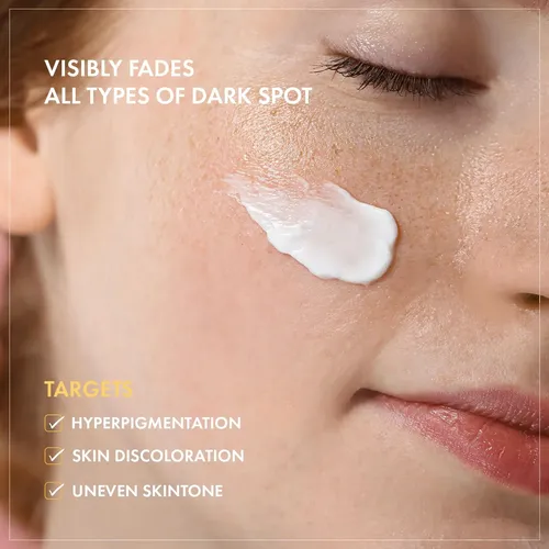 8 Days Spot Cream, Dark Spot Remover For Face, Age Spot,