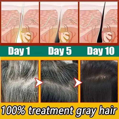 Crema A Base De Hierbas Para Cabello Blanco Contra Las Canas