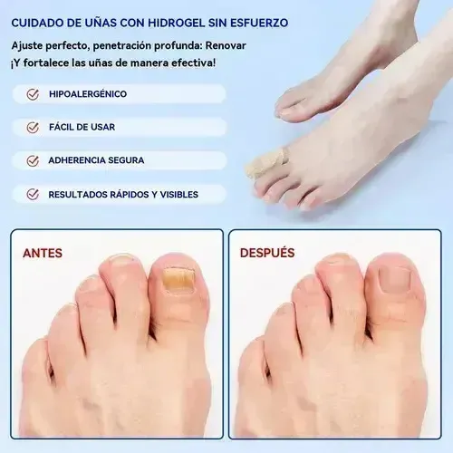 Parches Para Uñas Jf Fungal, 63 Unidades