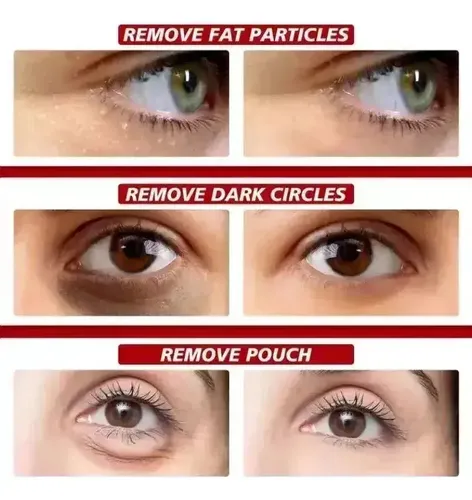 @ 2 Cremas Ojeras Arrugas Manchas Acido Kojico Contorno @
