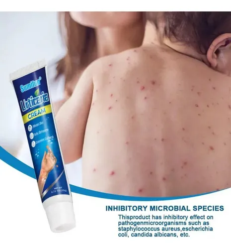 Qa/crema Antipruriginosa For Urticaria, 20 G, Antiherbales .