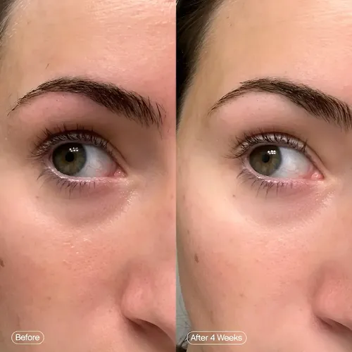 Parches Hidrogel Topicals Faded Para Ojeras Y Luminosidad Todo Tipo De Piel