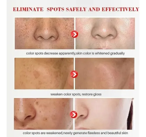 Wu- `pomada Facial Reparator For Branquear Manchas, .m