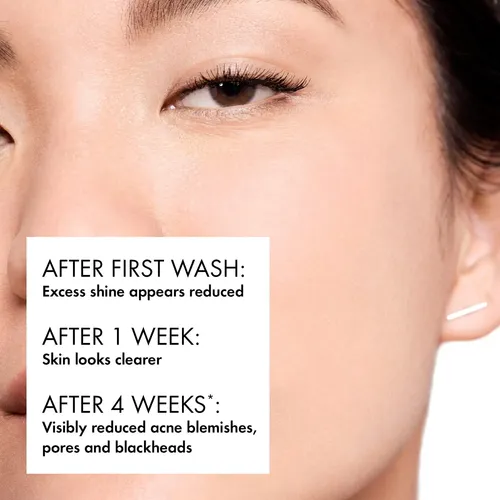 Jabón Facial Vichy Normaderm Daily Acne 0,5% De Ácido Salicí