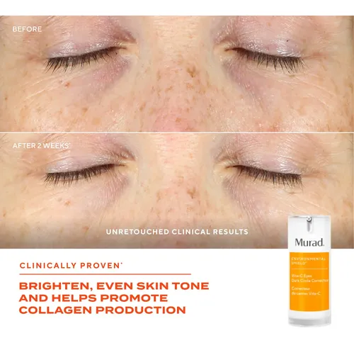 Corrector De Ojeras Murad Vita-c Eyes