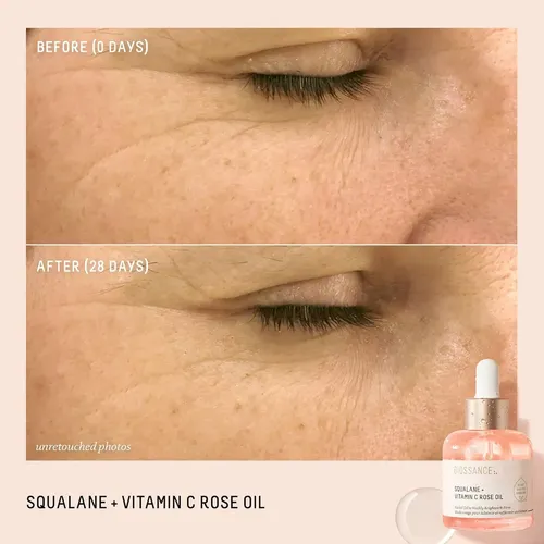 Sérum Facial De Rosa Renovador, Antiedad E Hidratante 30 `