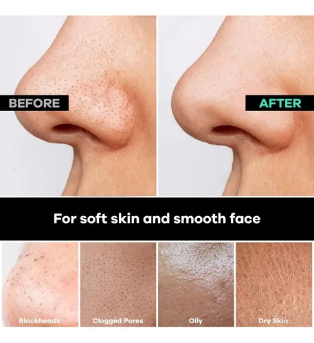 Manopla Facial Exfoliante Profunda Paquete De 2 Para Ducha