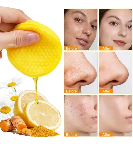 Mcúrcuma Kojic Ácido De Limpieza Almohadillas 50 Cuentasx