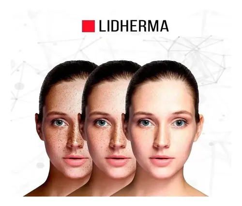 Fórmula Despigmentante Con Tranexamico Lidherma Por 50gr.