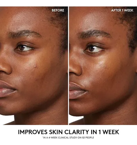 Tónico Bha Cherry Dub De Fenty Beauty Con Ácido Salicílico Y
