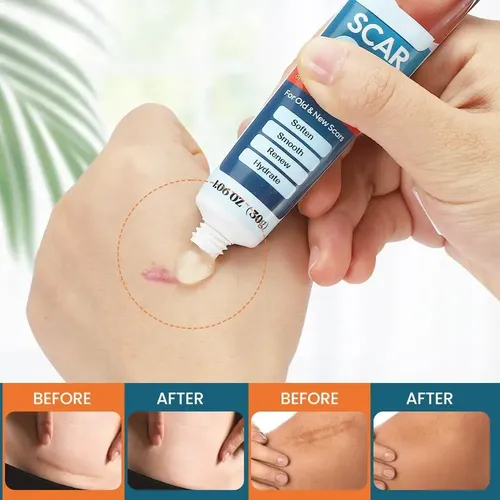 C De Crema Para Eliminar Cicatrices, Gel Avanzado Para Y