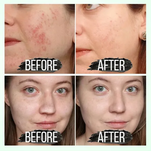 Mascarilla Facial Negra Sadoer Carbón Activado X2 80g Todo Tipo De Piel