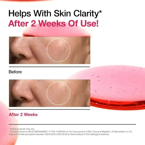 Esencia Tónica Facial Con Niacinamida 30ml Iluminadora