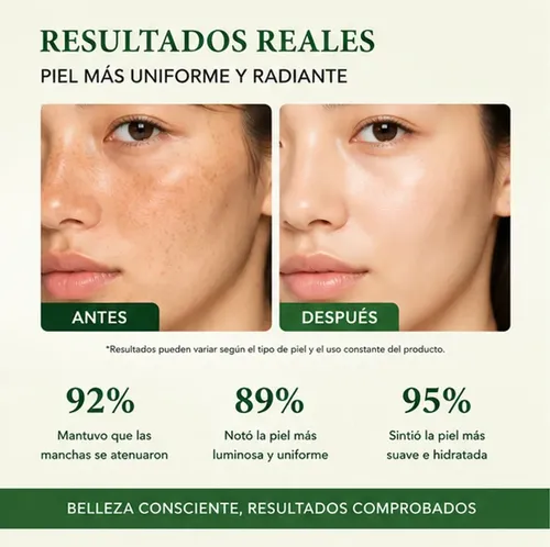 Crema Iluminante Correctora De Manchas Axis-y 50ml ^.^