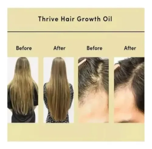 D 2pcs Aceite Esencial Para Cuidado Del Cabello Veganic D
