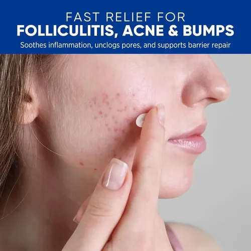 Crema Antifoliculitis Y Acné Aosorw 100 G