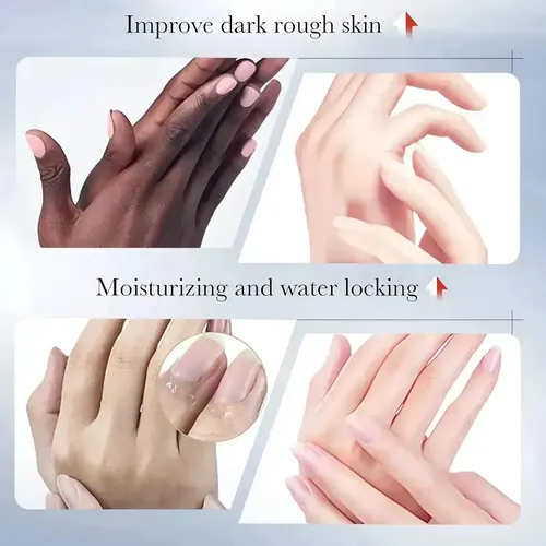 4 Set Manchas Aclarar Para Manos Crema Ácido Kojico Sadoer