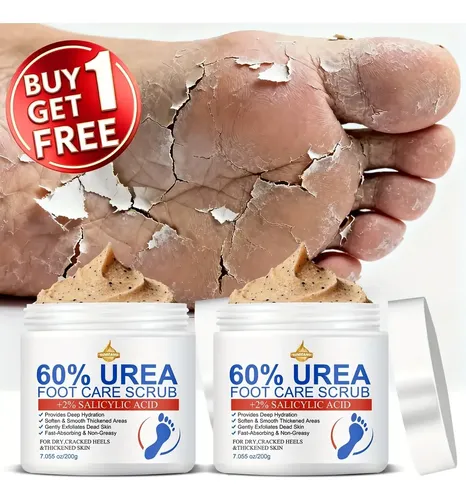 Crema Exfoliante Para Pies Con Urea 60% Y Ácido Salicílico
