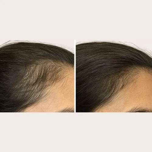 Cepillo Estimulante Para El Cabello Solaris Laboratories Ny