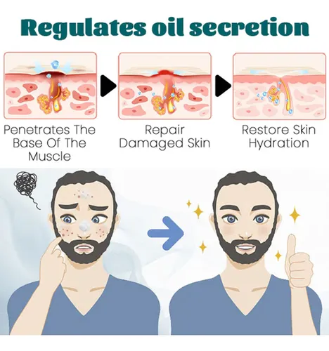 La Crema Facial Para Hombres Reduce Las Líneas Finas Y Las M