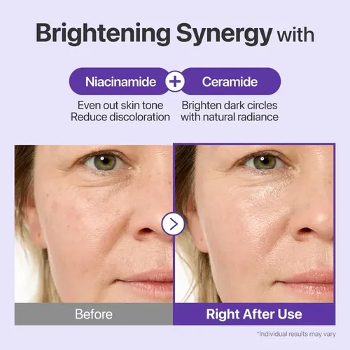 Crema De Ojos Numbuzin No.9 Nad+ Retinal Volumetox, Antiedad