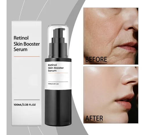 Sérum Retinal Boosts Retinol, Reparador Y Nutritivo Para El