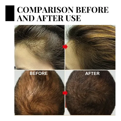 Spray Para El Cabello Batana Oil Boost, 30 Ml, Más Denso, Más Sal