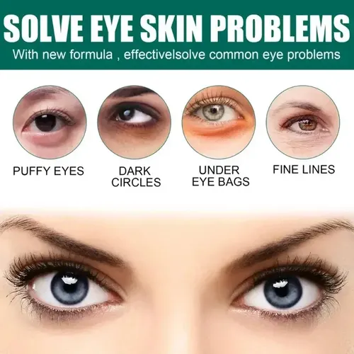 Crema Antiarrugas Antiarrugas De 7 Días Para Ojos Oscuroser