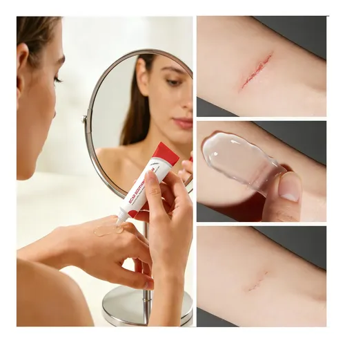 Scar Cream & Silicone Gel For Scar Removal – Natural,