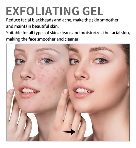 I Crema Blanqueadora Facial Para Cerrar Los Poros Abiertos Y