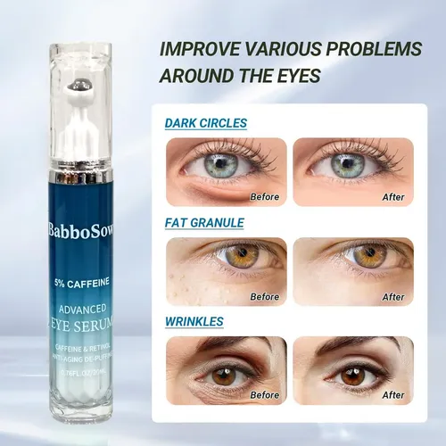 M Wh 2pcs Crema Y Ojos Con Cafeína Para Antienvejecimiento Y