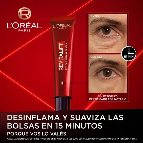 Contorno de Ojos Revitalift Laser L´Oreal Paris 15ml