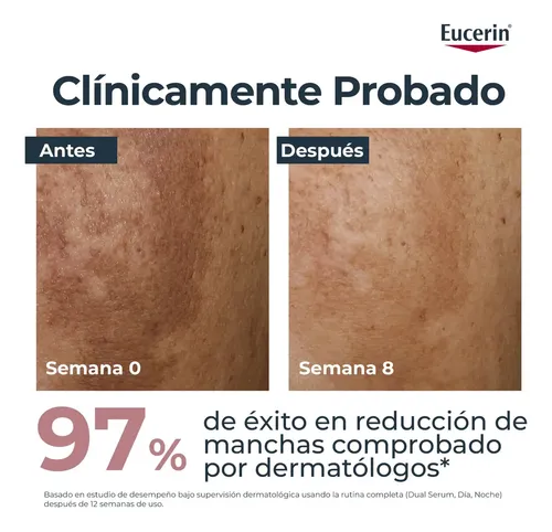Serum Facial Eucerin Anti-Pgiment Dual Serum 30ml
