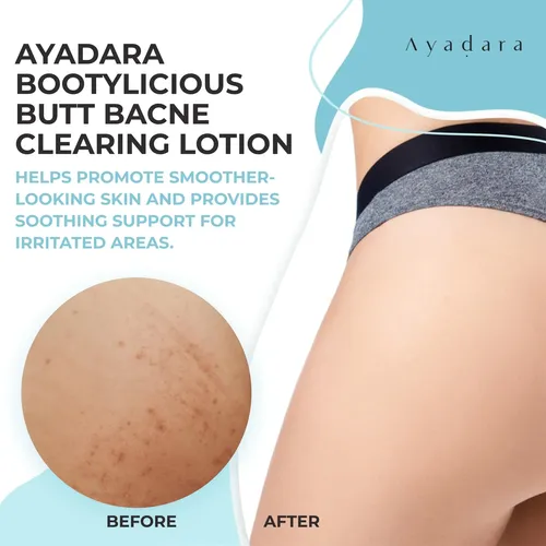 Loción Limpiadora De Acné En Glúteos Ayadara Bootylicious 24