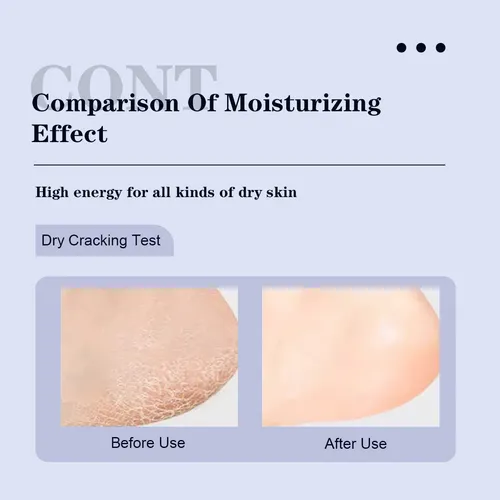 Crema Salicílica For Pies Con Aloe Y Árbol De Té 30 G