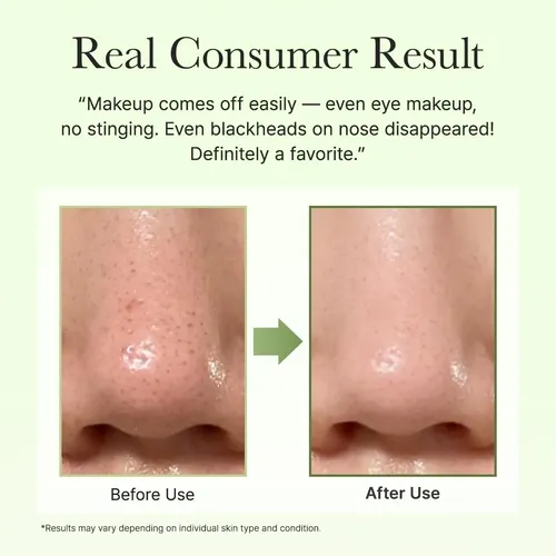 Arencia Pore Melt Phyto Pdrn Cleansing Bálsamo Limpiador