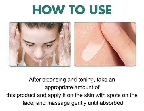 I Crema Iluminadora Facial Eelhoe Manchas Melasma Manchas Y