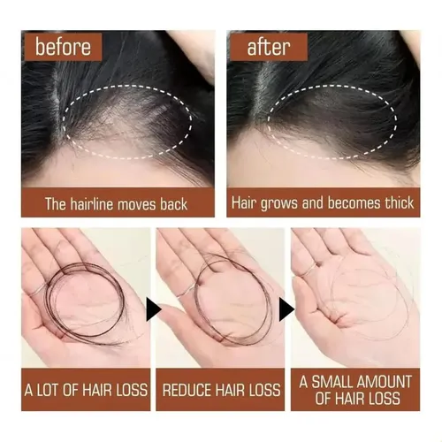 Fc Hair Oil Aceite De Batana Orgánico S