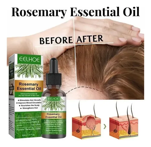 Aceite De Romero Para El Crecimiento Del Cabello, 30 Ml, Cre
