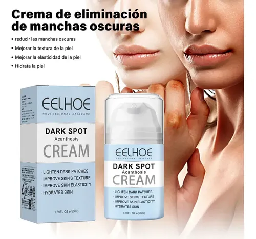 .zd Crema De Acantosis Nigricans, Mejora La .jh
