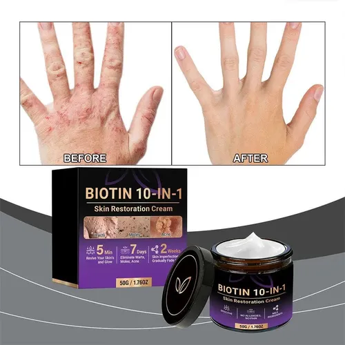 10 In 1 Skin Restoration Cream, Biotin 10 In 1 Cream For