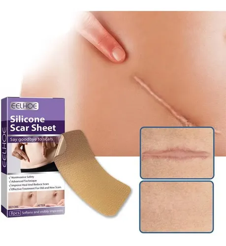 Láminas Indoloras Con Cinta Adhesiva De Silicona Para Repara