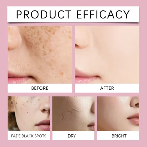 Crema Facial Iluminadora Hoygi, No Grasa, De Tono Uniforme