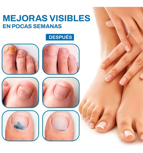 Crema Reparadora Uñas Antihongos Bálsamo Reparador