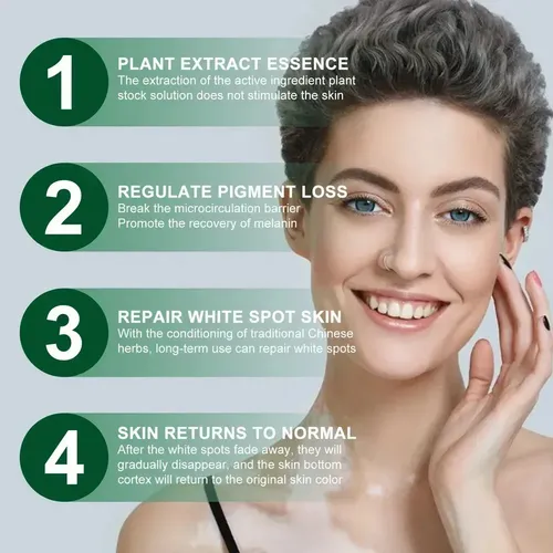 Cjw Tn 3 × Pomada Localizada Creme Vitiligo Branco M Para