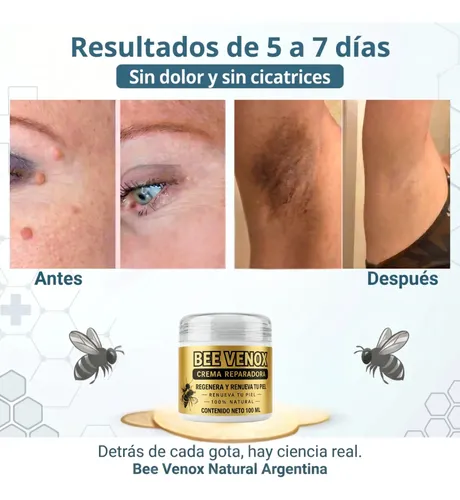 Bee Venox Quita Verrugas Cara Cuello Y Manos 100ml 2×1