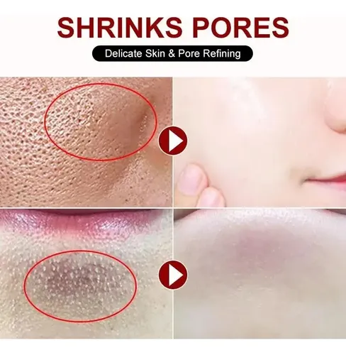Crema Facial Con Ácido Salicílico 20ml Para Poros