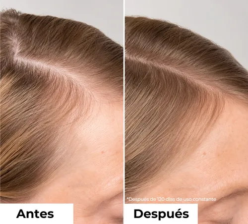 Pack X3 – Serum Capilar Fortalecedor Antiquiebre No Graso
