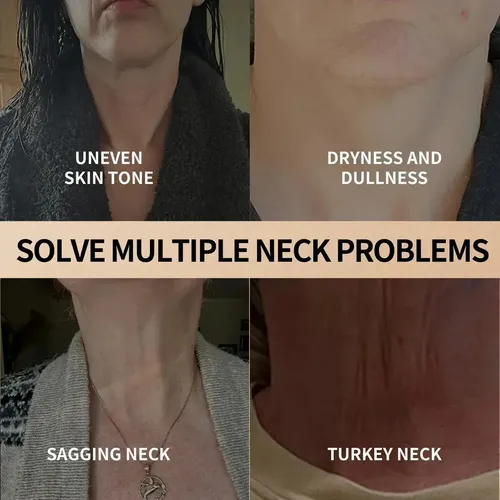 Xh Ttrtoo Crema Reafirmante Para Cuello Crema Reduce Líneas