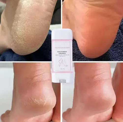 Crema Hidratante Para Pies, Crema Hidratante Para Pies Secos